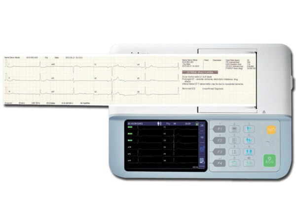 ECG MINDRAY BENEHEART R3